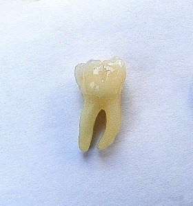 dente normale