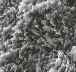Immagine a 10000 X a 10000 X al microscopio a scansione elettronica